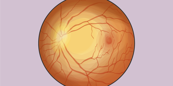 Systemic factors tied to retinal microvascular parameters in diabetic patients