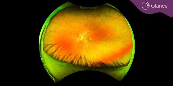 Retinal imaging avoids Stargardt's disease misdiagnosis