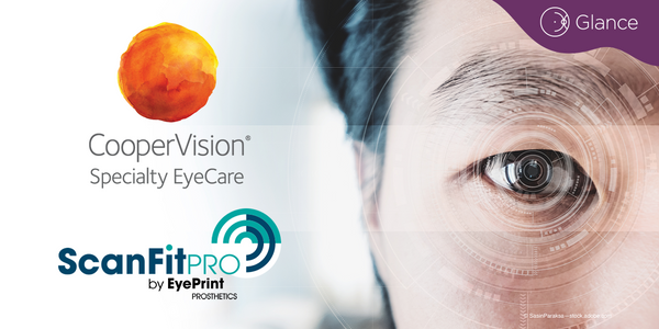 CooperVision now sole provider of SynergEyes’ scleral lens design system