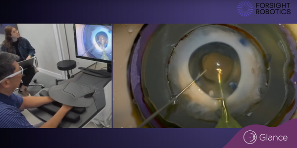 First-of-its-kind robotic cataract procedure makes debut at ASCRS