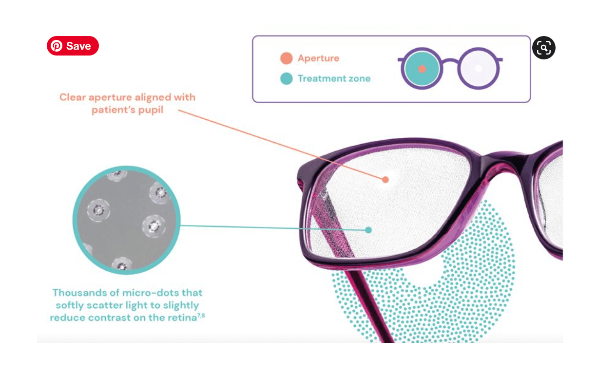 Spectacles For Myopia Control Four-year data continues to support DOT spectacle lenses for myopia